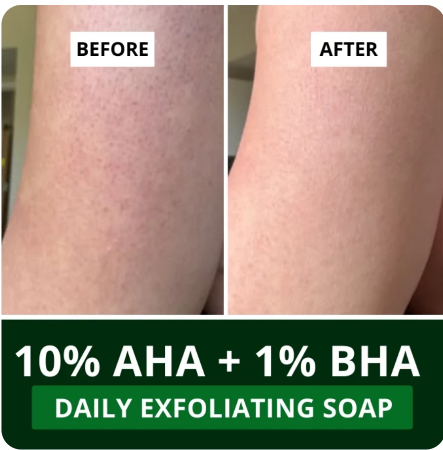 BAKE 10% AHA + 1% BHA Scrub Treatment Soap - Image 5